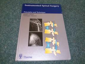 Instrumented Spinal Surgery: Principles and Technique