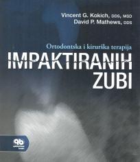 Ortodontska i kirurška terapija impaktiranih zubi