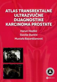 Atlas transrektalne ultrazvučne dijagnostike karcinoma prostate