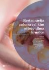 Restauracija zuba sa velikim oštećenjima krunice