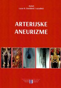 Arterijske aneurizme