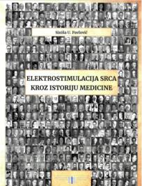 Elektrostimulacija srca kroz istoriju medicine